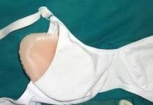 Mastectomy Bra- To Support Breast Prosthesis